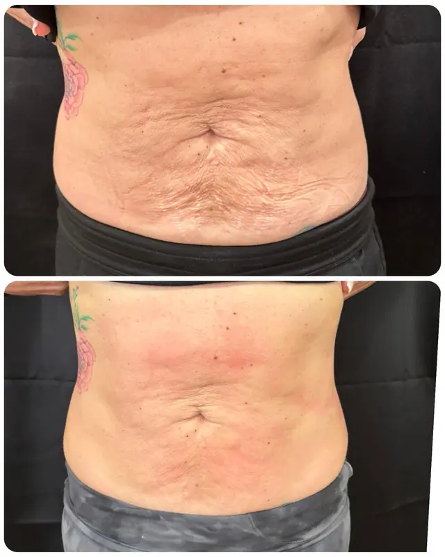 T-Shape 2 result — 3 sessions