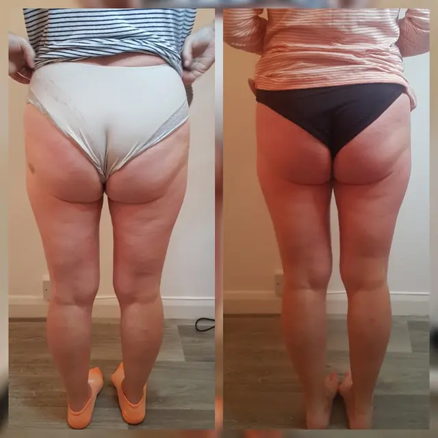 T-Shape 2 result — T shape after 2