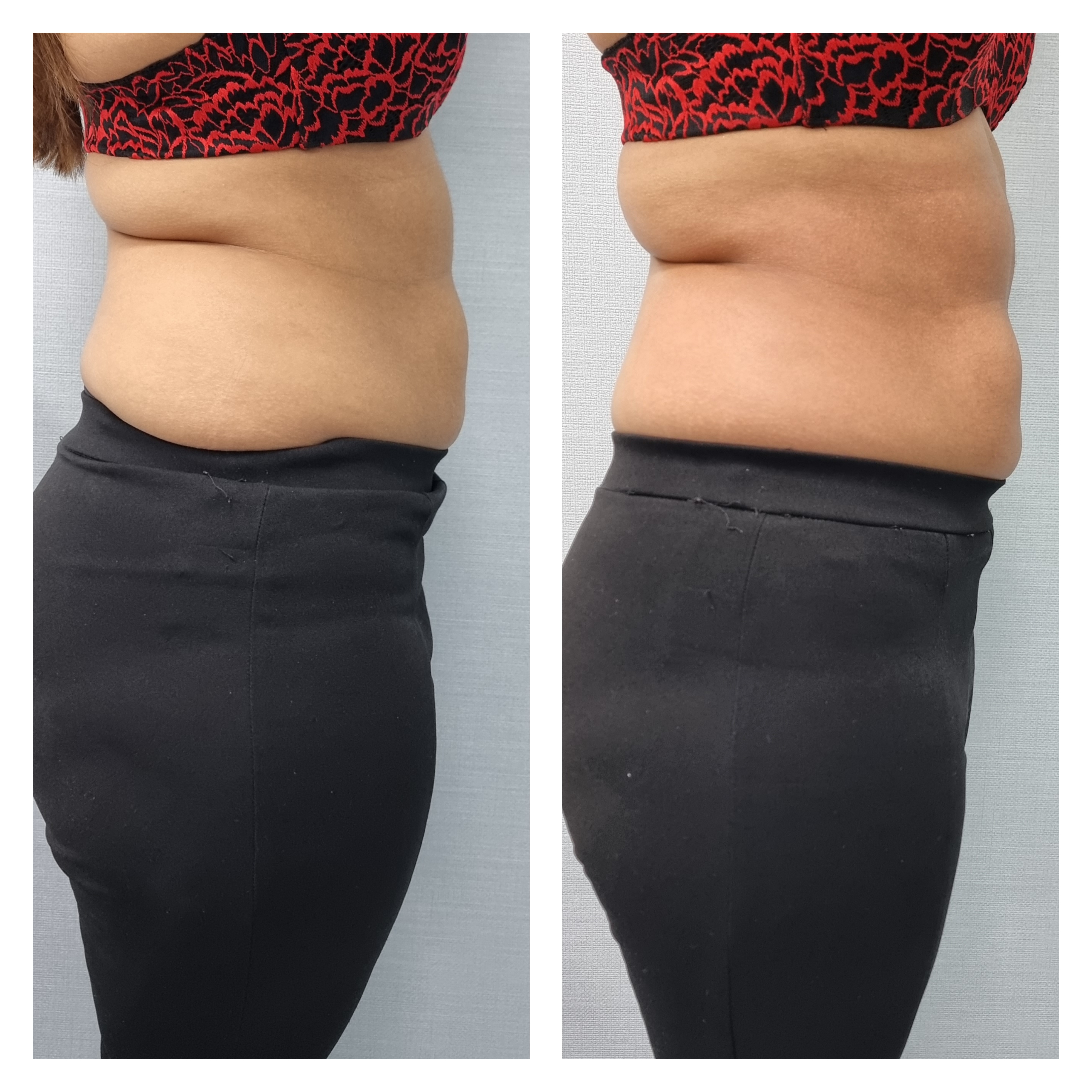 T-Shape 2 result — T shape2 after 1 permission to use